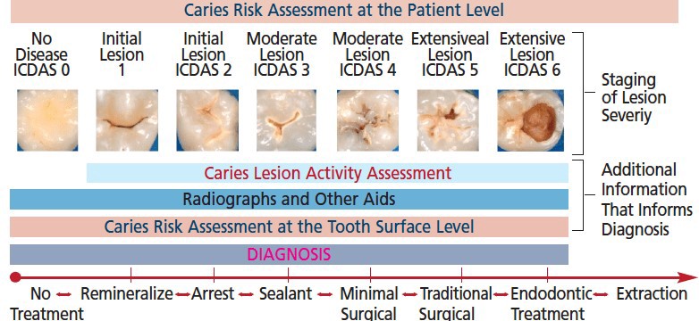 caries level