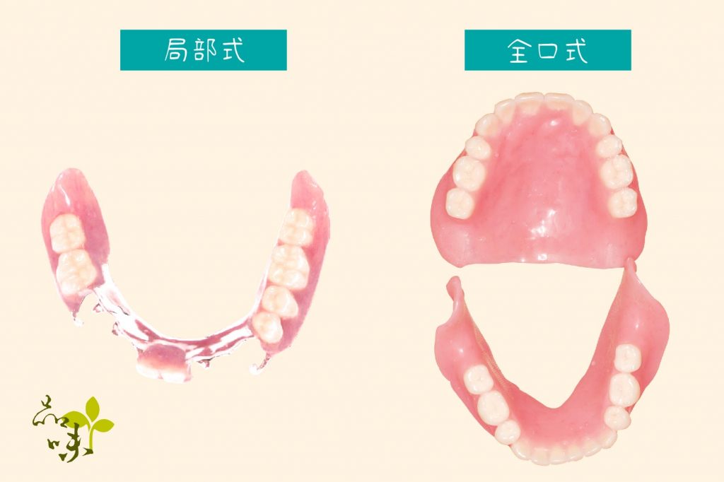 活動假牙