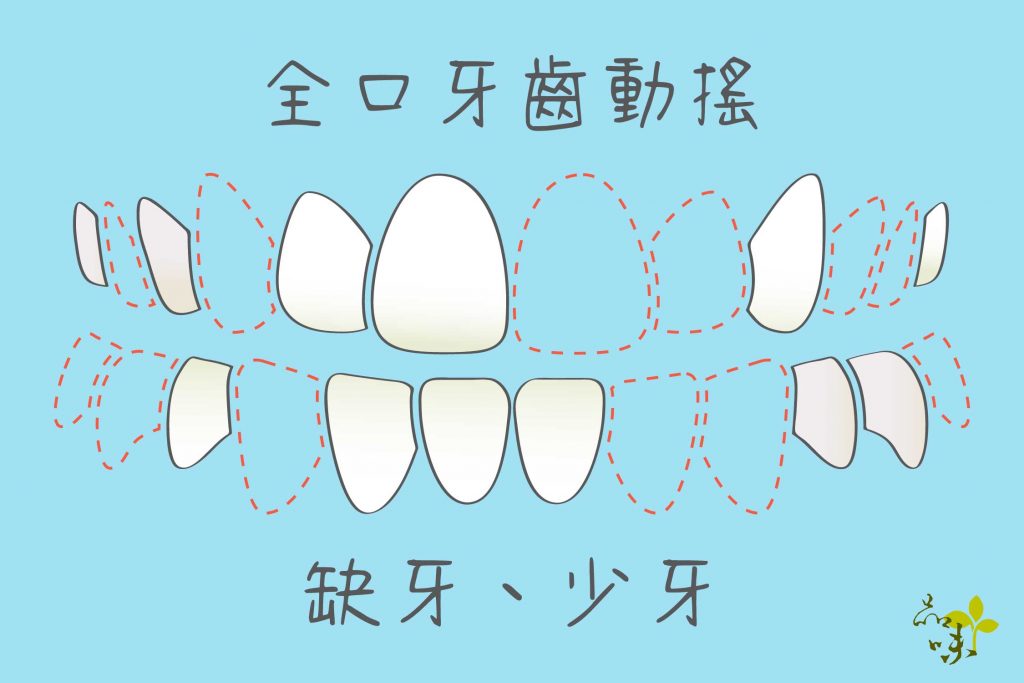  牙齒排列 