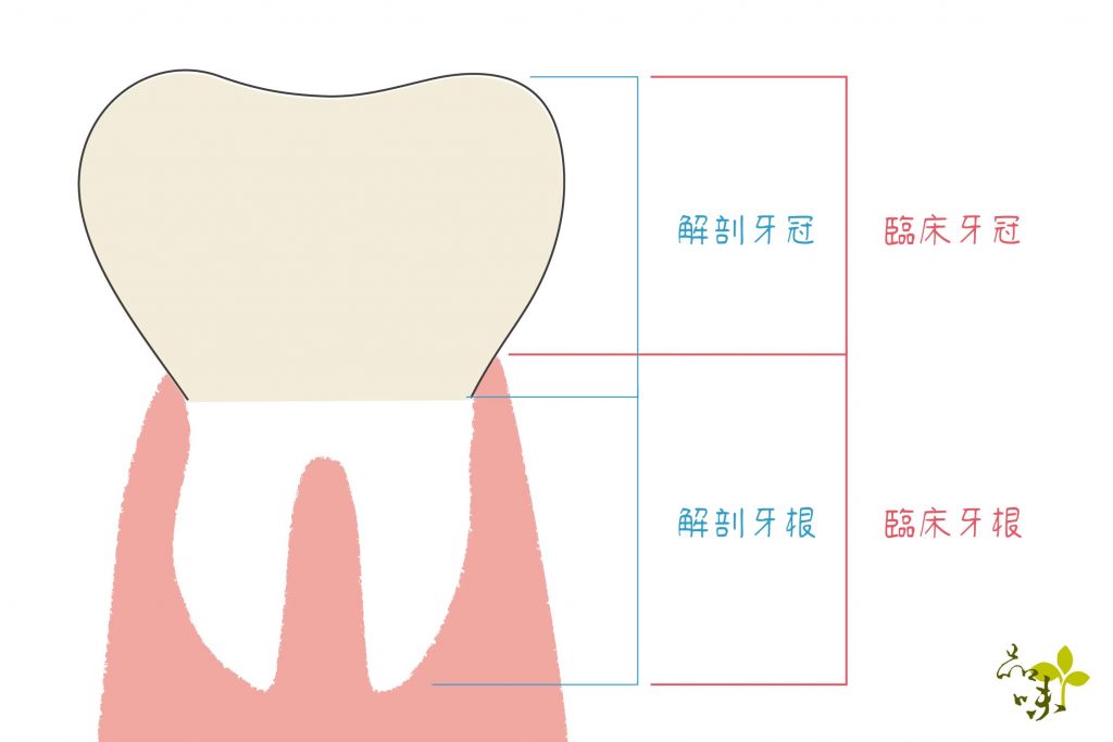 臨床牙冠和解剖牙冠的差別示意圖