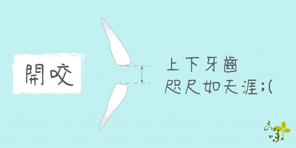 開咬