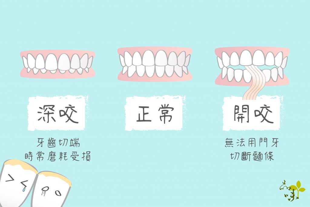 矯正