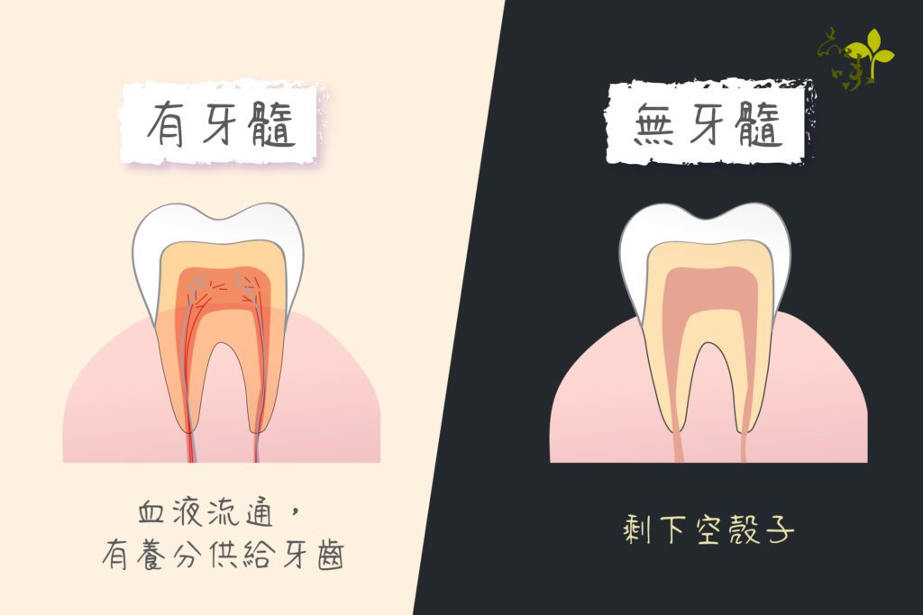 有牙髓的牙齒血液流通有養分