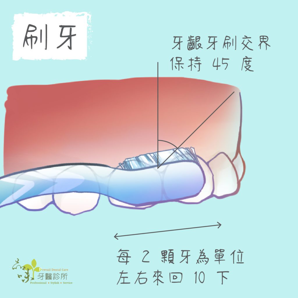 牙齒清潔 將牙齦牙刷交界呈四十五度角兩顆來回刷