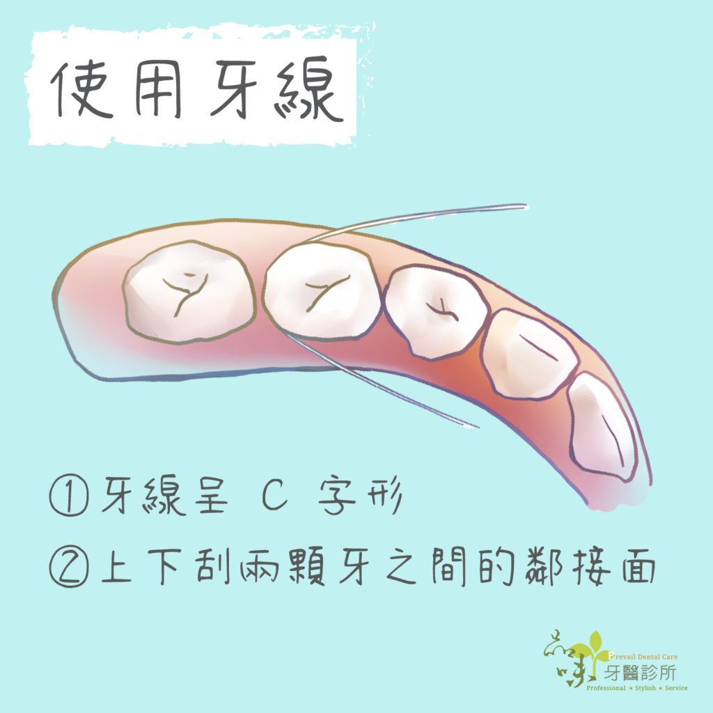 牙齒清潔 用牙線呈Ｃ型上下刮兩顆牙的鄰接面