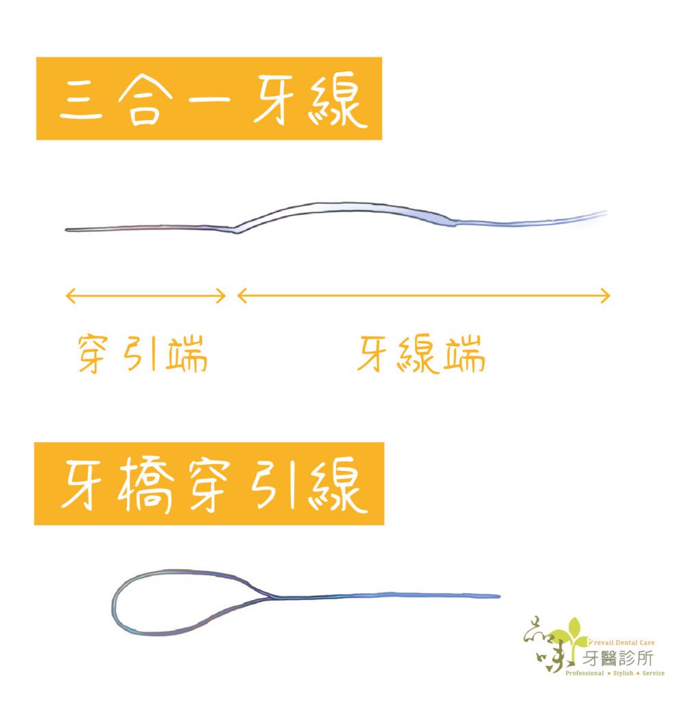 牙齒清潔工具:三合一牙線、牙橋穿引線