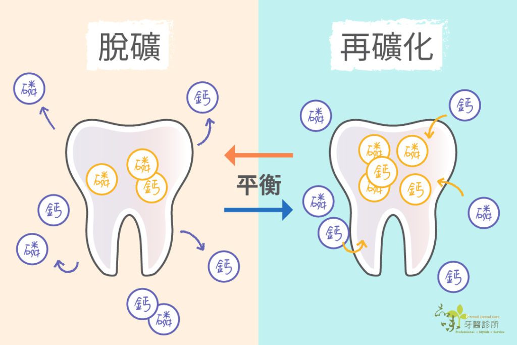 牙齒蛀牙 脫礦化 再礦化