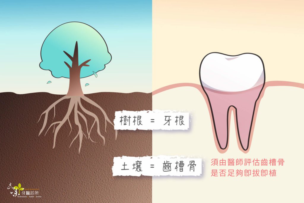 牙齒與齒槽骨與大樹在土壤裡的對比