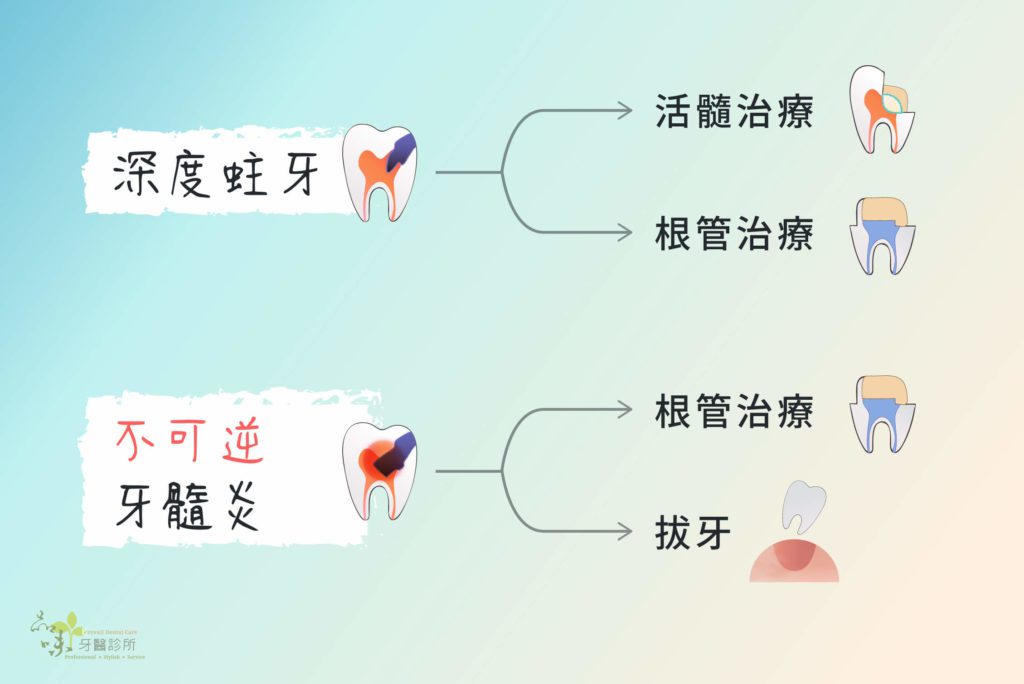 適用與不適用活髓治療的適應症