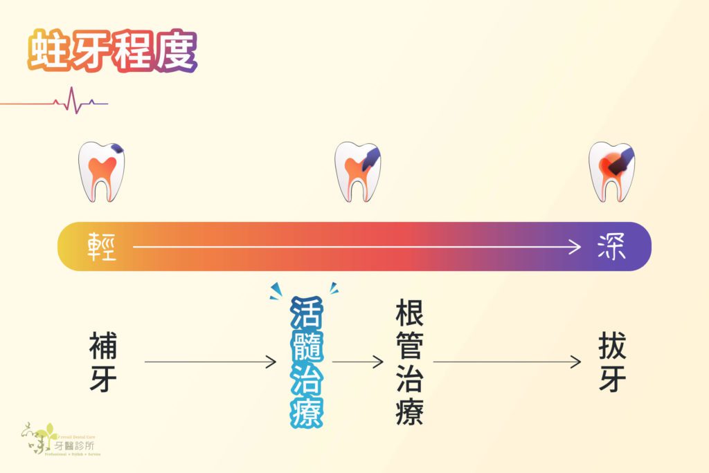 蛀牙進程圖與適合的治療方式