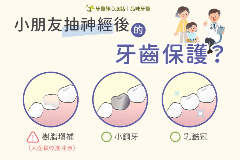 小朋友抽神經後的牙齒保護三種類型