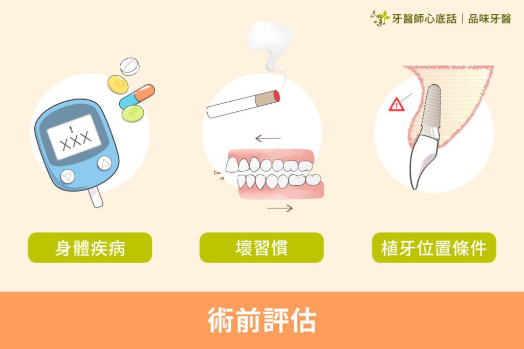 植牙術前評估身體疾病、壞習慣、植體位置條件