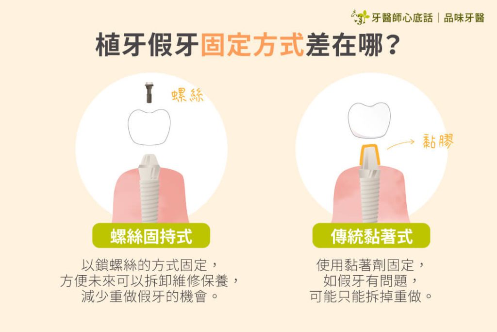 螺絲式可維修與黏著式植牙對比圖片