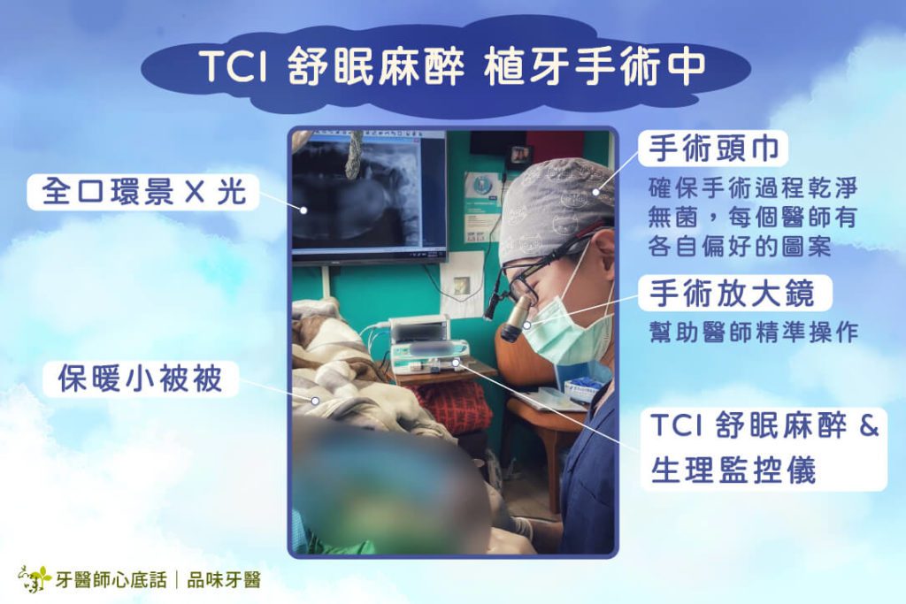 TCI 舒眠麻醉植牙手術中的流程操作