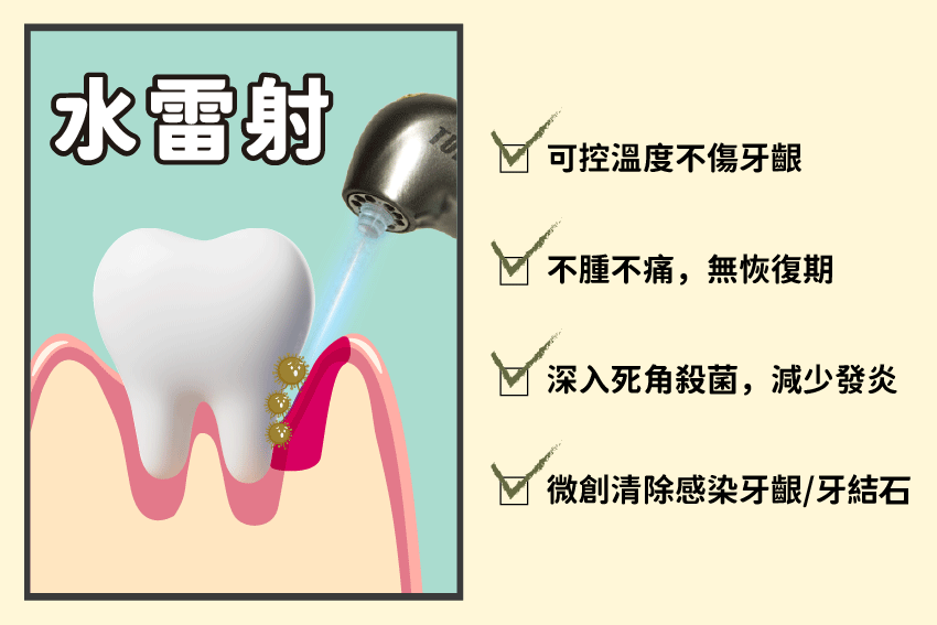 水雷射治療牙周病優點:可控溫度不傷牙齦、不種不痛無恢復期、深入死角殺菌減少發炎。
