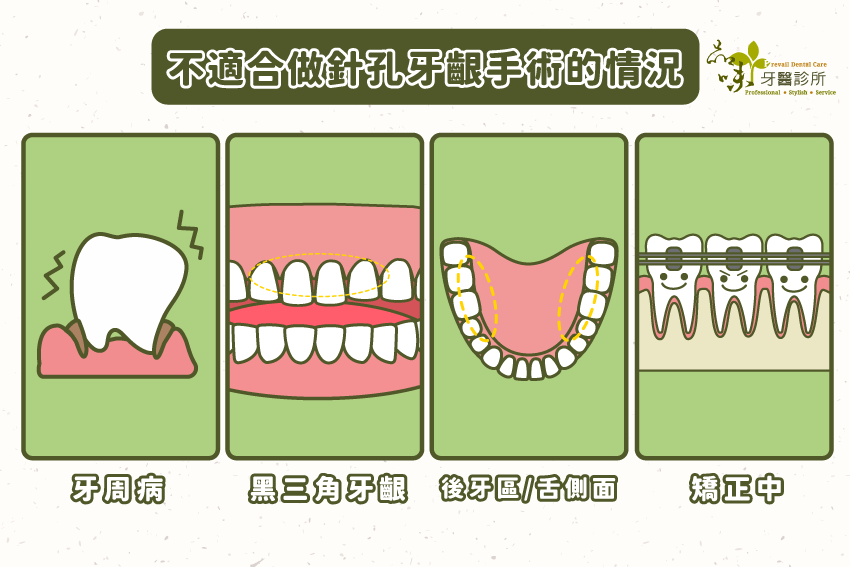 牙周病、黑三角牙齦、後牙區、舌側面、矯正中的牙齒不適合做針孔牙齦手術